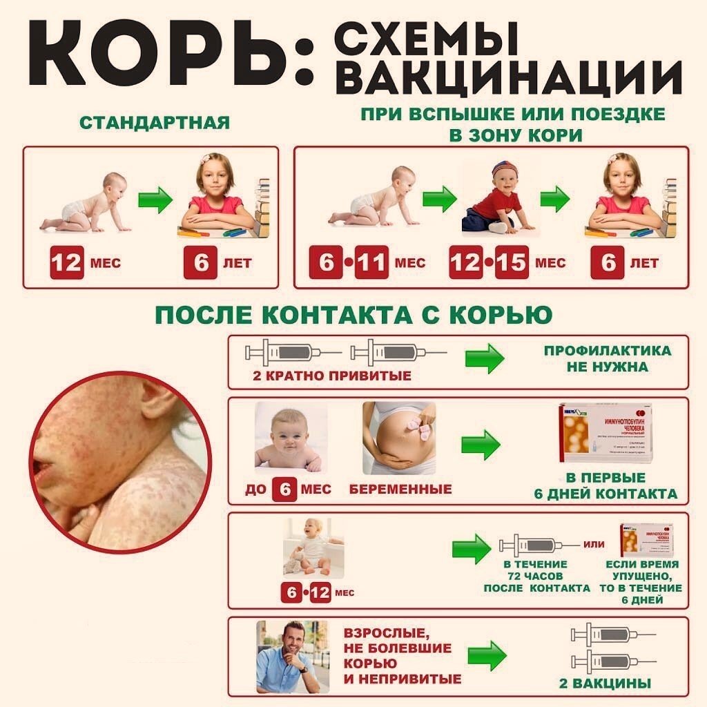 Корь возвращается … Иммунизация- жизненно важная мера!